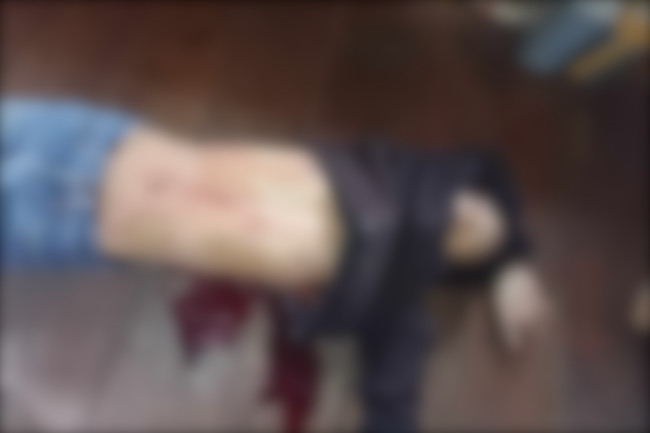 Serangan ke Polsek Homeyo, TPNPB OPM Klaim Tembak Mati Polisi, Polda Papua&nbsp;Membantah